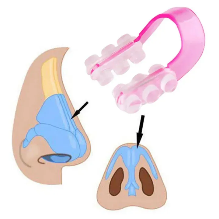 Nose Up Lifter Clip – Nose Bridge Shaping Tool — photo 3